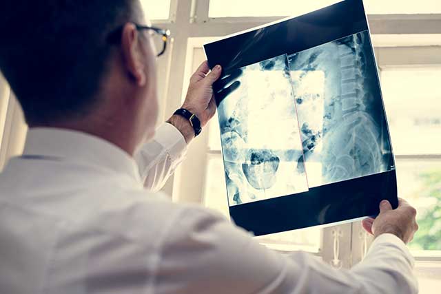 Doctor is checking patient x-ray film