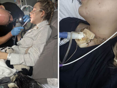 Cwmbran teen raises money for Teenage Cancer Trust after life‑saving treatment