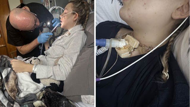 two photos of a teenage girl in a hospital bed being treated